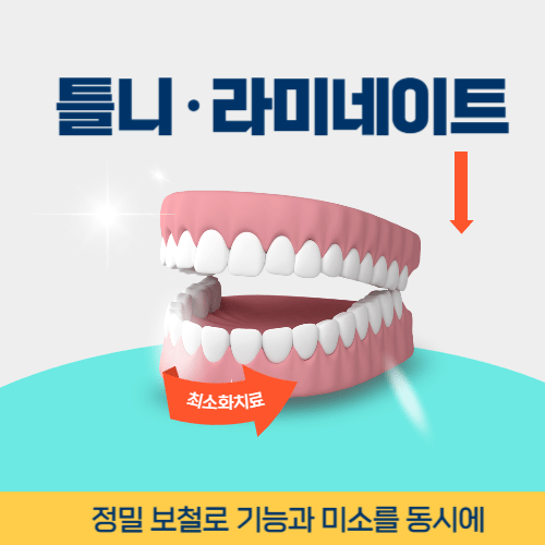 진주치과 진주시 치과 틀니 라미네이트