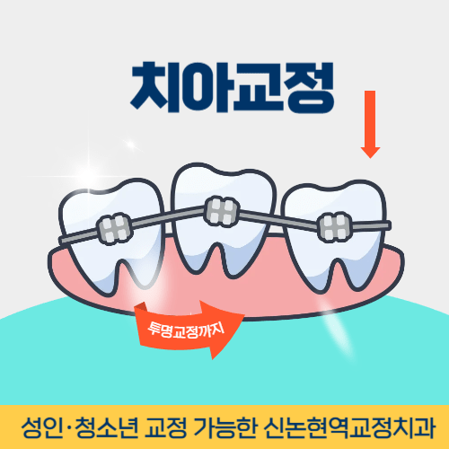 진주치과 진주시 치과 치아교정