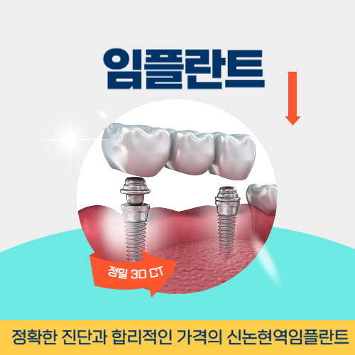 진주치과 진주시 치과 임플란트