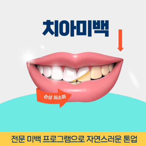 진주치과 진주시 치과 치아미백